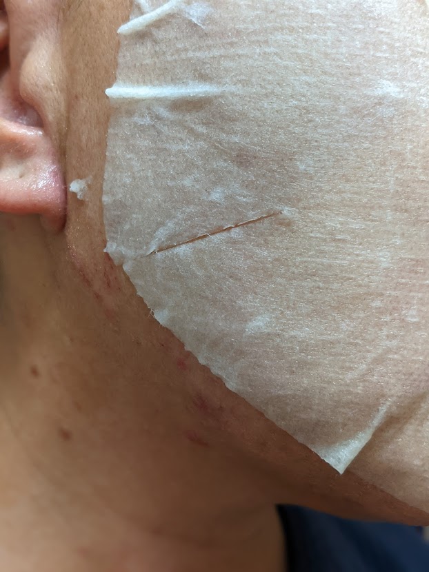 極濃　顔にシートマスクをはる。